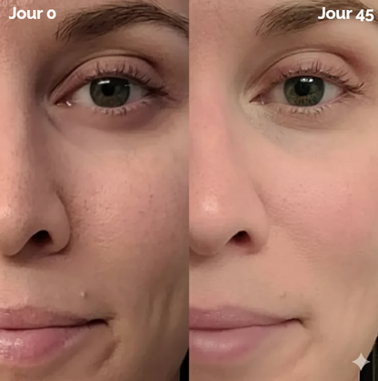 Baguette De Soin Visage 4-en-1 Lumière Rouge